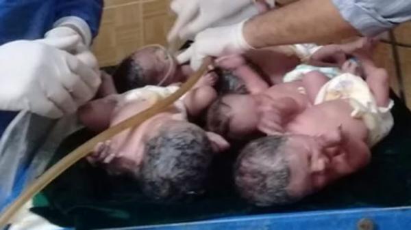 عشرينية مصرية ترزق بـ5 أطفال توائم (صور)