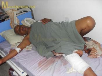 بالصور :اربعة قتلى .. وعشرات الجرحى في اعتداءات قوات الأمن على المتظاهرين اليوم في تعز