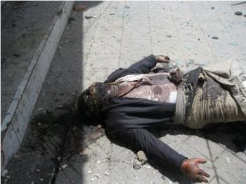 بالصور جثث تتحلل في الطرقات وبين الأنقاض ونداءات عاجلة لمنظمات الإغاثة العاملة في اليمن للتحرك لانتشال الجثث