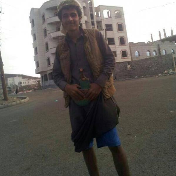 صورة الضحية قبل الجريمة وبعد الجريمة: قتل فتى في 17 من عمره بصنعاء واحراقه بـ "الأسيد" لطمس معالمه