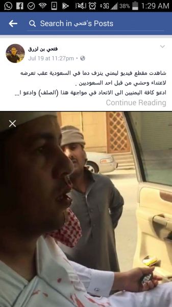 شاهد صور وفيديو: ردود افعال واسعة من اليمنيين والسعوديين على امير سعودي ضرب مغترب يمني حتى نزف دمه وسب امه الى قبرها