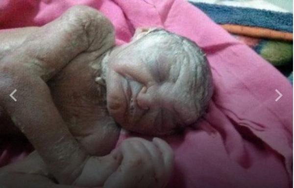 اليمن : في حالة نادرة بصنعاء طفل يلد بعمر اكبر من امة"90 عاما".. وردّة فعل أمه تثير ضجة "صورة"