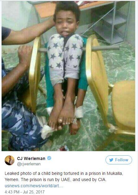 صحفي أمريكي يسرب صورةً لتعذيب أطفال في سجون المكلا السرية التي تديرها الإمارات