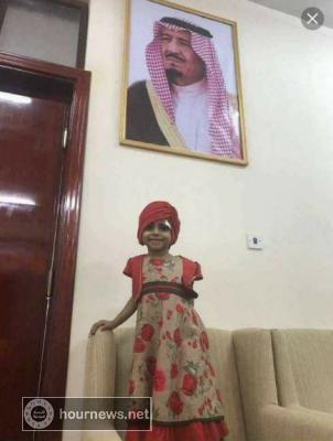 اليمن : اول موقف للحوثي بعد مغادرة الطفلة بثينة الريمي صنعاء الى السعودية