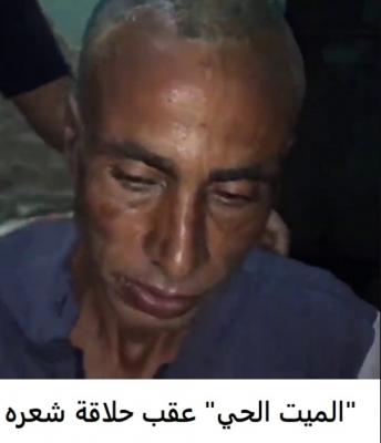 في أغرب واقعة.. العثور على مصري حيًا بعد دفنه بـ 4 أشهر