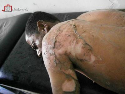 (شاهد صور) شاب يحرق جسده أمام رئاسة الوزراء