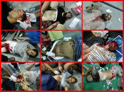 بالصور: مجزرة الحرس الجمهوري في مصر يوم امس والذي راح ضحيتها حوالي 70 شهيد ومئات الجرحى
