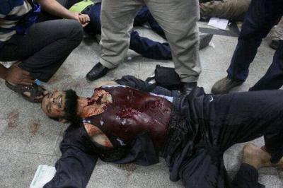 بالصور: مجزرة الحرس الجمهوري في مصر يوم امس والذي راح ضحيتها حوالي 70 شهيد ومئات الجرحى