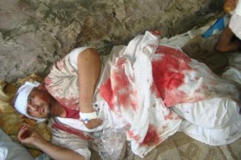 أسماء وصور الجرحي : الالاف يتوافدون إلى ساحة الحرية بعد أعمال البلطجة في محافظة إب