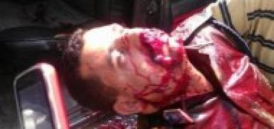اغتيال مدير قسم شرطة "عقيد" امام مستشفى الثورة في محافظة تعز