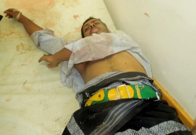 أحد مسلحي أنصار الشريعة يتلقى العلاج في مستشفى ابن سينأ بحضرموت (صور)