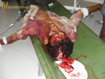 بالصور :اربعة قتلى .. وعشرات الجرحى في اعتداءات قوات الأمن على المتظاهرين اليوم في تعز