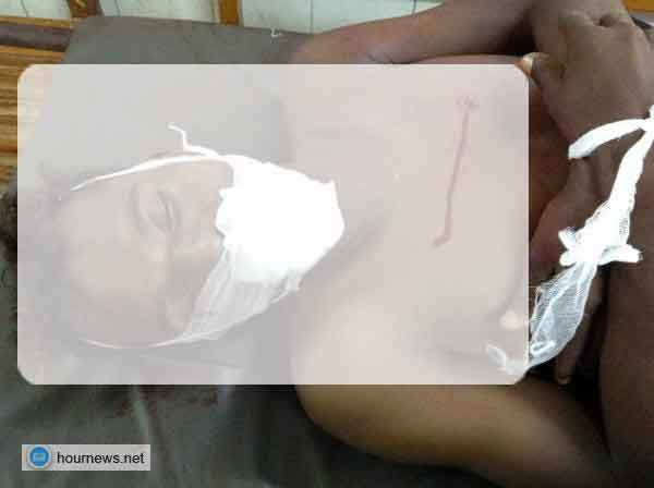 عاجل: مقتل مواطن واصابة اخر بجراح خطيرة في إطلاق نار عليهم من قبل الحوثيين بالحديدة (صور)