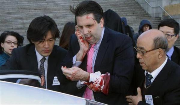 بالصور.. ضرب سفير أمريكا في كوريا الجنوبية بـ