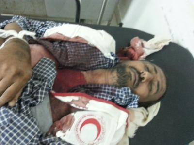 القوات الموالية للحوثيين ترتكب جريمة مروعة بحق طواقم طبية بعدن (صور)