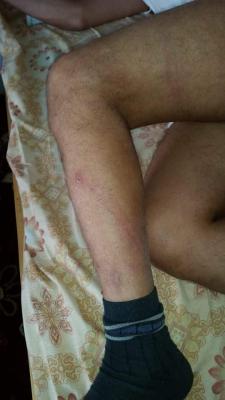 بالصور: القيادي علي البخيتي يتعرض للضرب من قبل جماعة الحوثي بصنعاء (تفاصيل)