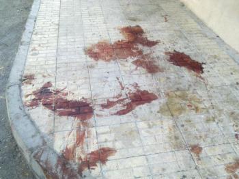صور اثار دماء الضحايا والقصف الذين سقطوا يوم امس السبت 15-10-2011 ، إثر القصف العشوائي من أتباع الأحمر بقذائف الهاون