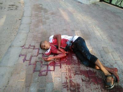 جريمة قتل مروعة في وضح النهار في عدن واعتقال رفيق المقتول (صور)
