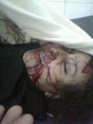 إنقلاب سيارة سبع مرات وبداخلها العروسة في محافظة المحويت(صور)