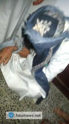 عاجل : انفجار الوضع بين الحوثيين واهالي شبام كوكبان بالمحويت-- صور
