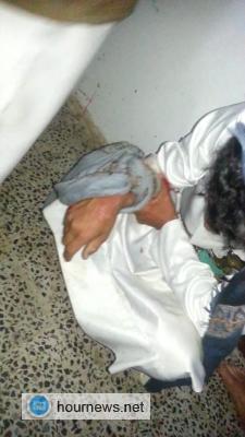 عاجل : انفجار الوضع بين الحوثيين واهالي شبام كوكبان بالمحويت-- صور