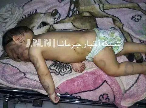 شاهد بالصور :من لم يمت برصاص الحرب مات بسلاح الجنون” .. أبّ سوري يقتل طفلته “عضاً”