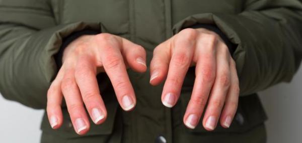 تعرف على أهم الأسباب التي تسبب رعشة اليدين وكيفية العلاج